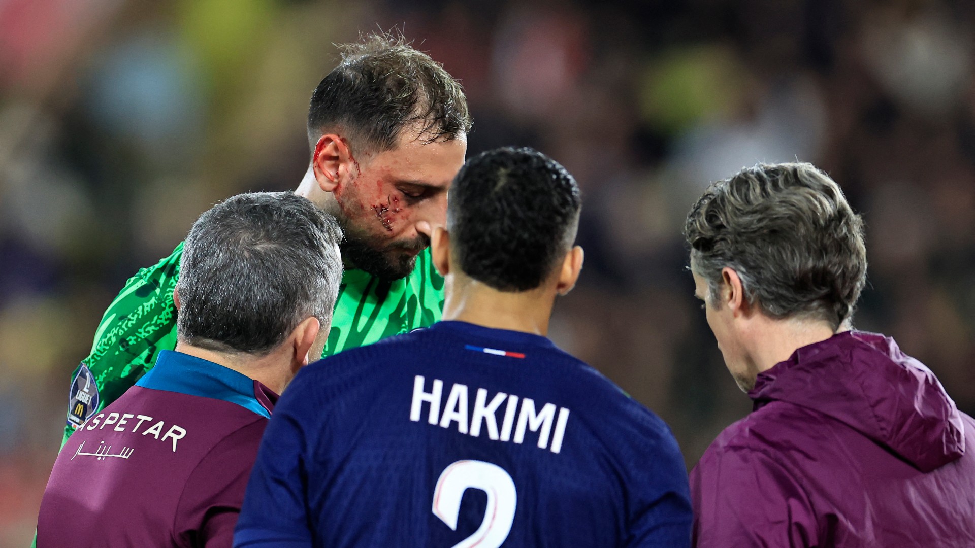 Donnarumma suffers face injury