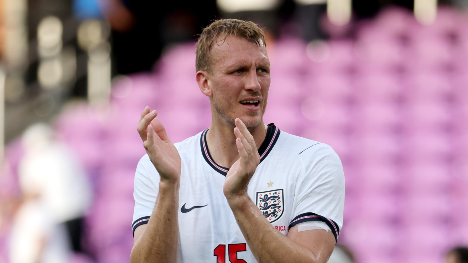 Burn wants to see England unity